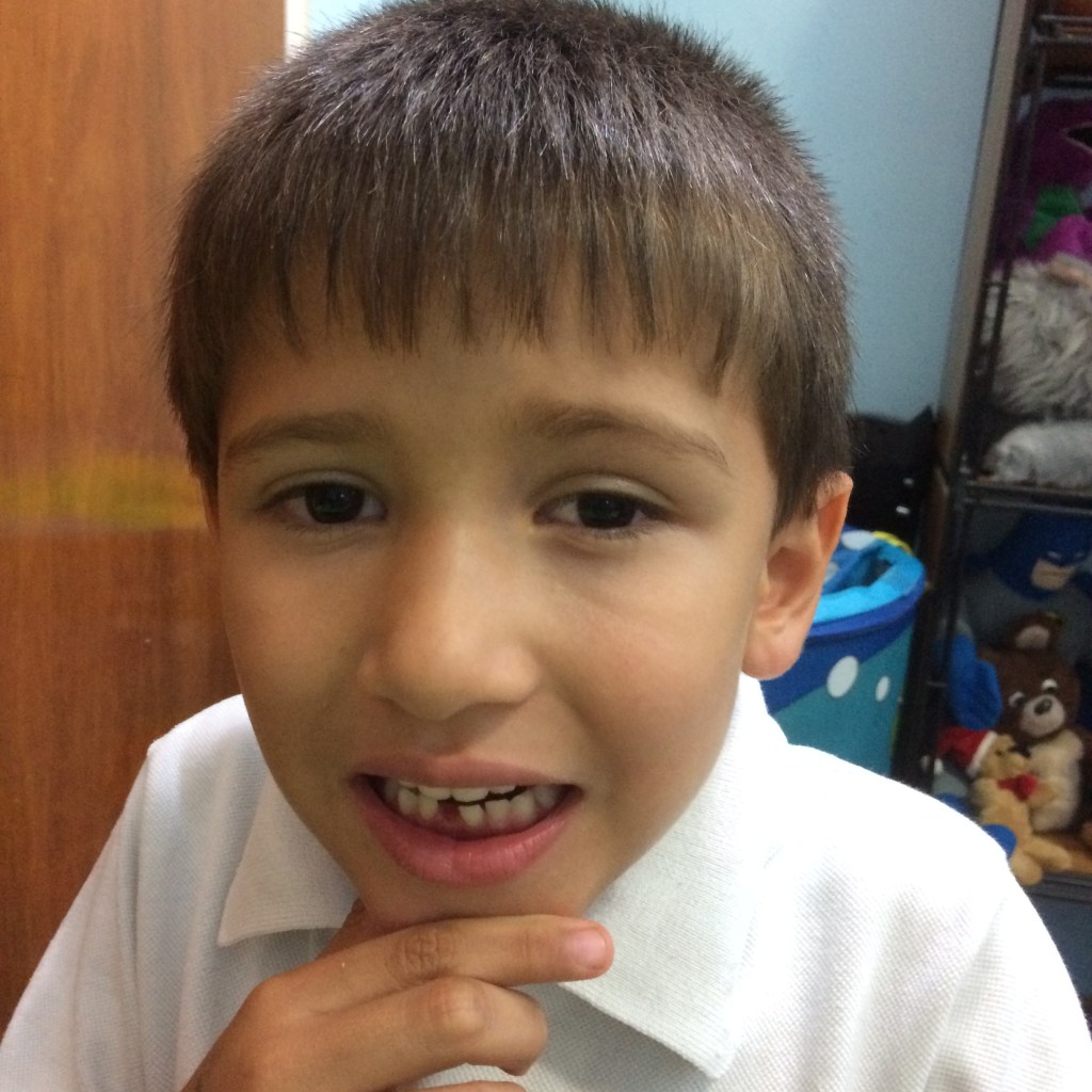 ¡Y se cayó el&nbsp;diente!