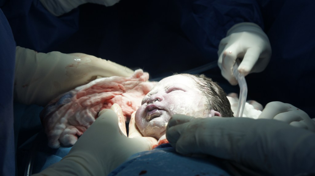 21 meses atrás… Llegó el&nbsp;segundo